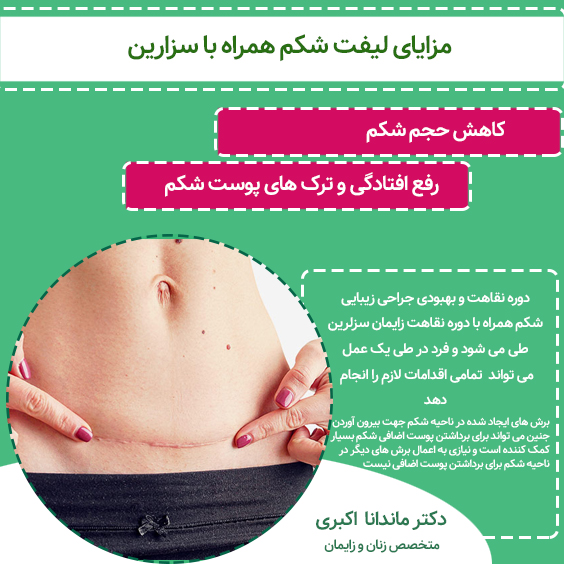 لیفت شکم 