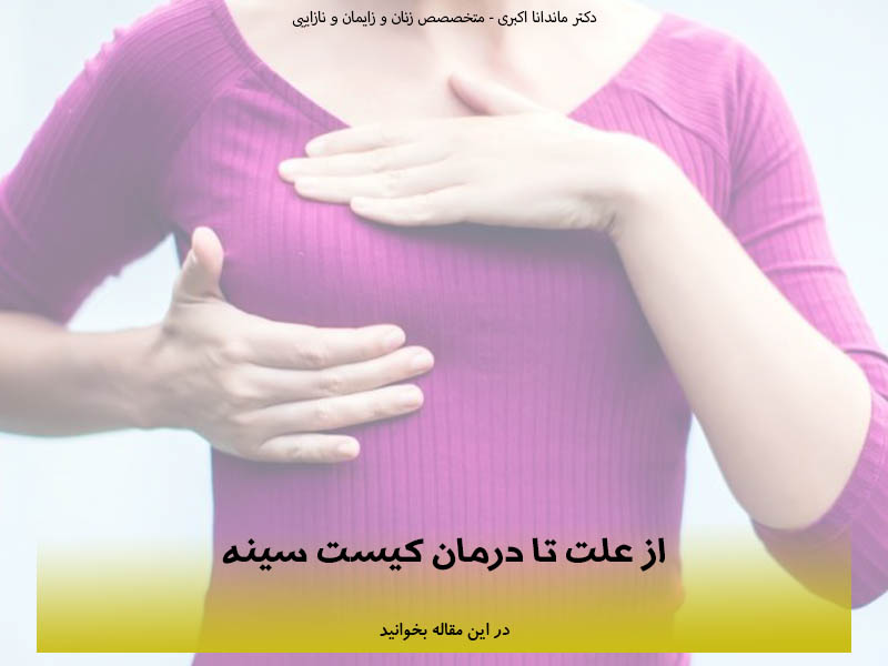 از علت تا درمان کیست سینه